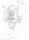 Fig. 01 - Knee joint endoprosthesis