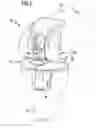 Fig. 02 - Knee joint endoprosthesis