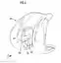 Fig. 03 - Knee joint endoprosthesis
