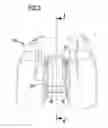 Fig. 04 - Knee joint endoprosthesis