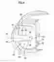 Fig. 05 - Knee joint endoprosthesis