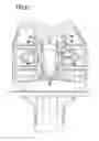Fig. 13 - Knee joint endoprosthesis