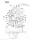 Fig. 15 - Knee joint endoprosthesis