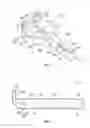 Fig. 02 - Prosthetic knee implant systems and methods with linked tibial rotation