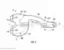 Fig. 03 - Prosthetic knee implant systems and methods with linked tibial rotation