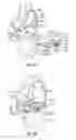 Fig. 10 - Prosthetic knee implant systems and methods with linked tibial rotation