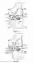 Fig. 11 - Prosthetic knee implant systems and methods with linked tibial rotation