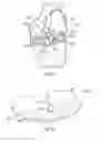 Fig. 13 - Prosthetic knee implant systems and methods with linked tibial rotation