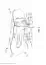 Fig. 06 - Expanding interbody implant and articulating inserter and methods of use