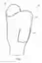 Fig. 02 - INTERCHANGEABLE LOCAL INTERFACE PROSTHETIC SOCKET APPARATUS AND SYSTEM