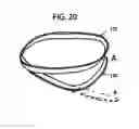 Fig. 09 - Stent with one-way sock valve