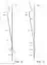 Fig. 08 - Internal iliac preservation devices and methods