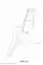 Fig. 10 - Internal iliac preservation devices and methods
