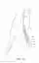 Fig. 13 - Internal iliac preservation devices and methods
