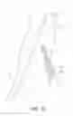 Fig. 15 - Internal iliac preservation devices and methods