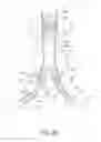 Fig. 22 - Internal iliac preservation devices and methods