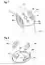 Fig. 07 - Pivoting-limitable biaxial joint