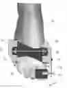 Fig. 01 - Foot orthosis with comprehensive method for correcting deformities of the transverse arch of the foot in cases of static transverse flatfoot compounded by hallux valgus, with possible preventive and post-operative applications.
