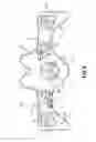 Fig. 08 - Semi rigid cervical collar