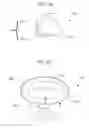 Fig. 04 - Dental appliance