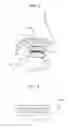 Fig. 05 - Dental appliance