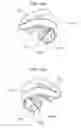 Fig. 07 - Dental appliance