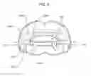 Fig. 10 - Dental appliance