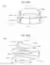 Fig. 11 - Dental appliance