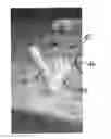 Fig. 01 - PORTABLE BLOWER FOR SUPPLYING VENTILATION TO WOUNDS