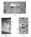 Fig. 02 - PORTABLE BLOWER FOR SUPPLYING VENTILATION TO WOUNDS