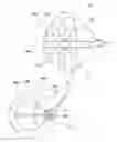Fig. 01 - INCISION PORTION STRUCTURE, HAVING REINFORCEMENT PORTIONS TO BE FORMED ON CORNEA, FOR REMOVING LENTICULE INCISED ACCORDING TO EYE SIGHT CORRECTION SURGERY