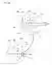 Fig. 07 - INCISION PORTION STRUCTURE, HAVING REINFORCEMENT PORTIONS TO BE FORMED ON CORNEA, FOR REMOVING LENTICULE INCISED ACCORDING TO EYE SIGHT CORRECTION SURGERY