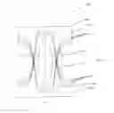 Fig. 17 - Article with chassis having an elastic distribution, absorbent core and system and method for making same