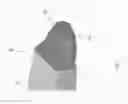 Fig. 07 - Quantification of force during soft tissue massage for research and clinical use