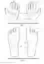 Fig. 04 - Proprioceptor Stimulation Material