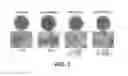 Fig. 04 - Method and composition for lightening skin using a cell culture extract