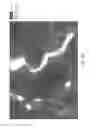 Fig. 14 - MESOSCALE NANOPARTICLES FOR SELECTIVE TARGETING TO THE KIDNEY AND METHODS OF THEIR THERAPEUTIC USE