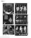 Fig. 05 - Injectable Cryogel Vaccine Devices and Methods of Use Thereof