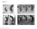 Fig. 29 - Injectable Cryogel Vaccine Devices and Methods of Use Thereof