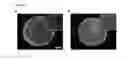 Fig. 44 - Injectable Cryogel Vaccine Devices and Methods of Use Thereof