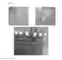 Fig. 50 - Injectable Cryogel Vaccine Devices and Methods of Use Thereof