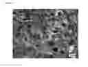 Fig. 52 - Injectable Cryogel Vaccine Devices and Methods of Use Thereof