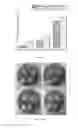 Fig. 12 - Polymer fiber scaffolds and uses thereof