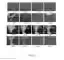 Fig. 24 - Pharmaceutically acceptable salts of B-Guanidinopropionic acid with improved properties and uses thereof