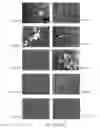 Fig. 30 - Pharmaceutically acceptable salts of B-Guanidinopropionic acid with improved properties and uses thereof