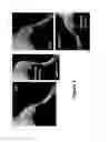 Fig. 06 - Compositions and methods for treating bone diseases