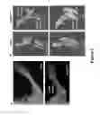 Fig. 08 - Compositions and methods for treating bone diseases