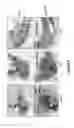 Fig. 09 - Compositions and methods for treating bone diseases