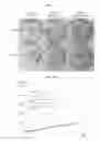 Fig. 09 - Method of inhibiting quorum sensing in 