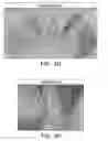 Fig. 06 - METHODS AND COMPOSITIONS FOR THE TREATMENT OR PREVENTION OF PARKINSON'S DISEASE
